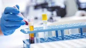 Calcitonin can be used to detect thyroid cancer in early stages. Detecting Cancer Early With New Blood Test