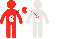 Kidney Transplant At Ssh Jammu Very Soon Kidney Transplant Jammu Organ Transplant