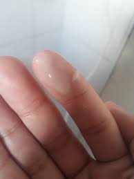 Corrimento Secrecao 37 Semanas Foto Abril De 2019 Babycenter