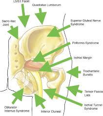 The inferior cluneal nerve is also named as gluteal branch of posterior femoral cutaneous nerve. Diagnosis And Treatment Of Pudendal Nerve Entrapment Syndrome Subtypes Imaging Injections And Minimal Access Surgery In Neurosurgical Focus Volume 26 Issue 2 2009