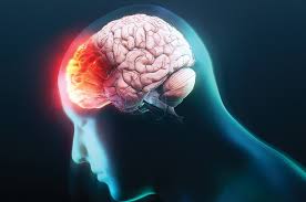 Image result for Concussion