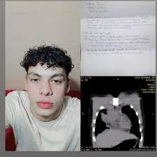 Fundraiser by CARLOS LUIS MATOS HERNANDEZ : Ayuda para Samuel graterol