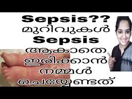 The inflammation in sepsis can produce blood clots and leaking blood vessels. What Is Sepsis How To Prevent Sepsis And Septic Shock Malayalam Mothersnursing Youtube