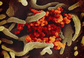 The average number of daily new coronavirus cases in kane county grew steadily between july 9. Coronavirus Tracker How Many Covid 19 Cases Are There In Canada And Worldwide The Latest Maps And Charts The Globe And Mail