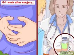 However, in most cases, a woman can choose to place her baby for adoption without her parents' permission. 3 Ways To Get An Abortion Teens Wikihow