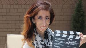 Incroyable idée tendance coupe & coiffure femme 2017/ 2018. Lizzie Velasquez La Femme La Plus Moche Du Monde Soutenue Par Des Stars Pour Sa Campagne Femme Actuelle Le Mag