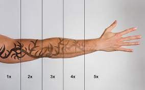 Does laser tattoo removal treatment safe? Essential Laser Tattoo Removal Costs Are They Scary Tattoo Nexus
