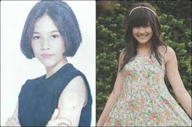 Vitamin k membantu batang dan akan rambut tetap kuat, sedangkan vitamin a mendorong kulit kepala untuk menghasilkan lebih banyak rambut. Bzi R 3vikg2em