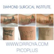 While tattoos are generally considered permanent, it is now possible to remove them with treatments, fully or partially. Laser Tattoo Removal Specialist Encino Ca Diamond Surgical Institute Cosmetic Surgeon