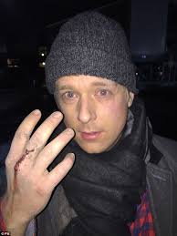 X Factor's G4 punched after mugger tried to steal laptop