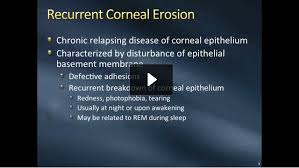 Pin On Pinecone Vision Center