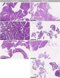 Age-Related Decline in Pancreas Regeneration Is Associated With an  Increased Proinflammatory Response to Injury