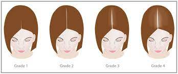 Deficiencies are rare, but many women take supplements because it seems to improve the condition of their hair and nails. Plantur 39 Symptoms Of Hair Loss In Women During The Menopause