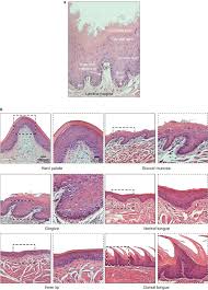 The tumour forms sheets, nests and rarely ribbons. Oral Epithelial Stem Cells In Tissue Maintenance And Disease The First Steps In A Long Journey International Journal Of Oral Science