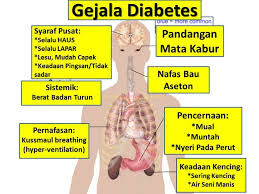 We did not find results for: Mengenal Penyakit Gula Mulai Dari Penyebab Gejala Hingga Cara Mengatasinya