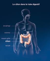El cáncer de colon suele afectar a los adultos mayores, aunque puede ocurrir a cualquier edad. Le Colon Cancer Du Colon