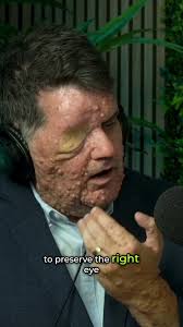 Incredible Journey: 7 Brain Surgeries That Inspire