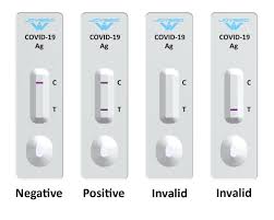 What happens after a positive test? Covid 19 Antigen Rapid Test Kit Joysbio Biotechnology