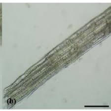 Image result for Gymnosporia oxycarpa