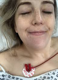 Woman paralyzed from neck down in horror accident after attempting  dangerous yoga move