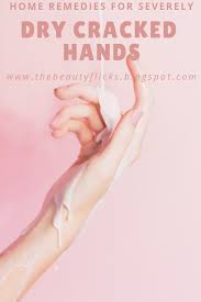 Home Remedies For Severely Dry Cracked Hands Dry Cracked Hands Cracked Hands Hand Treatment