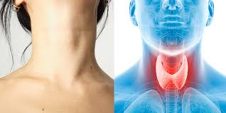 One differentiated type, papillary, usually grows in one of the two lobes of. 9 Signs Of Thyroid Problems Self