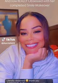 Where Did Jasmine Youtuber Get Her Teeth Done at