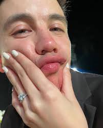 Omg! Congressman Arjo Atayde and Maine Mendoza are now engaged! 💍 “Wait,  whaaaat??? We're engaged?! 🤯,” Maine wrote