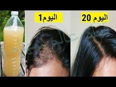 pin by magdy soliman on صحتك تهمنا hair care oils beauty recipes hair facial skin care routine