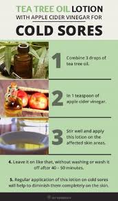 Tea Tree Oil Remedy For Cold Sores Cold Sores Remedies Remedies Best Tea Tree Oil