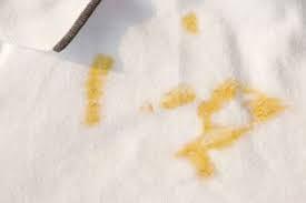 Οι πιο αποτελεσματικοί τρόποι για να αφαιρέσετε λεκέδες μουστάρδας από τα ρούχα χρησιμοποιώντας απλά υλικά