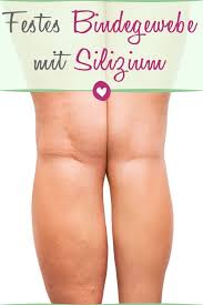 Silizium Starkt Ein Schwaches Bindegewebe Bindegewebsschwache Abnehmen Silizium