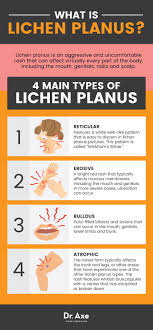Pin On Health