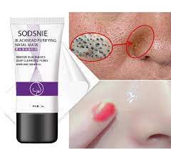 The worst thing about blackheads is that you never really notice them unless they are embarrassingly visible on your face. China Blackhead Remover Nose Mask Skin Care Acne Treatment Pimple Cream Anti Acne Scar Facial Care Tools Face Mask Face Cream China Blackhead Tear Mask And Acne Acne Nasal Membrane Price