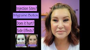 Those who have had botox are advised to avoid exercise and hot baths in the days immediately following the treatment to prevent sweating out the injected treatment. Botox For Migraines Droopy Brow Side Effects Does It Work Youtube