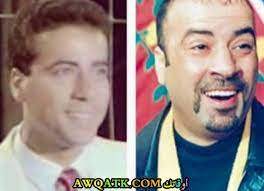 موعد حفل محمد حماقي في السعودية. Ù…Ø´Ø§Ù‡ÙŠØ± Ø§Ù„ÙÙ† Ø§Ù„Ø¹Ø±Ø¨ Ù‚Ø¨Ù„ ÙˆØ¨Ø¹Ø¯ Ø§Ù„Ø´Ù‡Ø±Ø© Ùˆ Ø¹Ù…Ù„ÙŠØ§Øª Ø§Ù„ØªØ¬Ù…ÙŠÙ„