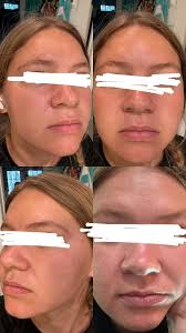 Hey All! Any tips or product recommendations for this? My pores look like  creaves and craters and I hateeeee it! I know nothing will completely get  rid of them but looking for