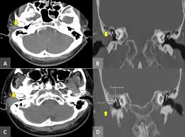 Image result for Centrostigma papillosum