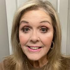 How to manage and treat eczema?