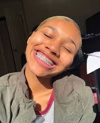 We did not find results for: 100 Braces Colors Ideas Braces Colors Braces Cute Braces
