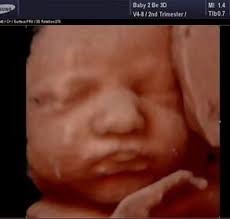 We did not find results for: F A Q Baby To Be 3d