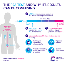 Hence, prostate specimens are frequently encountered in surgical pathology practice. Why A One Off Psa Test For Prostate Cancer Is Doing Men More Harm Than Good Cancer Research Uk Cancer News