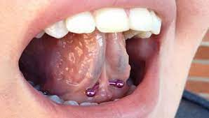Tongue Web Piercing 45 Image Ideas Pros Cons Jewelry Right Piercing