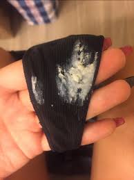 The appearance of a yeast infection, or candidiasis, depends on its location. Tmi Picture Yeast Infection Glow Community