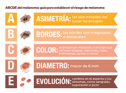 The abcde melanoma skin cancer assessment rule is very helpful in identifying suspicious moles that could be cancerous. Descubre La Exposicion M De Melanoma Y Aprende A Prevenirla