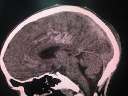 Pin On Ct Head