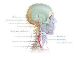 Treatment for severe carotid stenosis involves eliminating the artery blockage. How Many Carotid Arteries In The Neck Overview Of The Head And Neck Region Amboss The Internal Carotid Artery Latin Koreanmusicspace