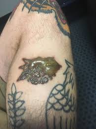 We do know that tattoos can cause several types of chronic inflammation. Tattoo Removal Before And After Reddit Tattoo Design