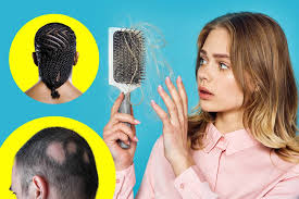 How to treat hair loss caused by extreme weight loss. How To Recognize Prevent And Treat Hair Loss And Damage Las Vegas Weekly