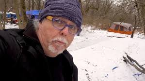 Randy's hand is frostbitten. He is homeless in Syracuse sleeping outside in  the winter!